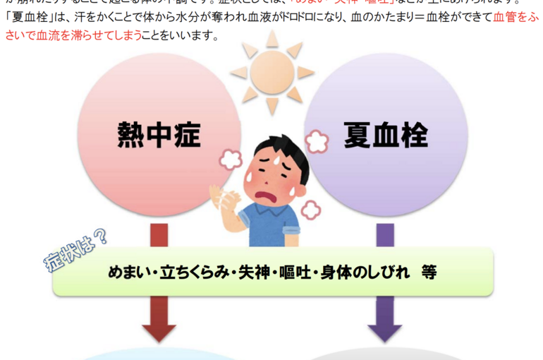 【梅田　整体院　夏バテ】夏血栓（熱中症）に要注意！！