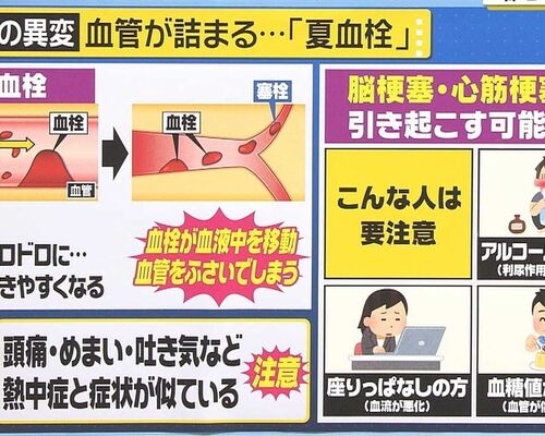 【梅田　整体院　夏バテ】夏血栓（熱中症）に要注意！！j
