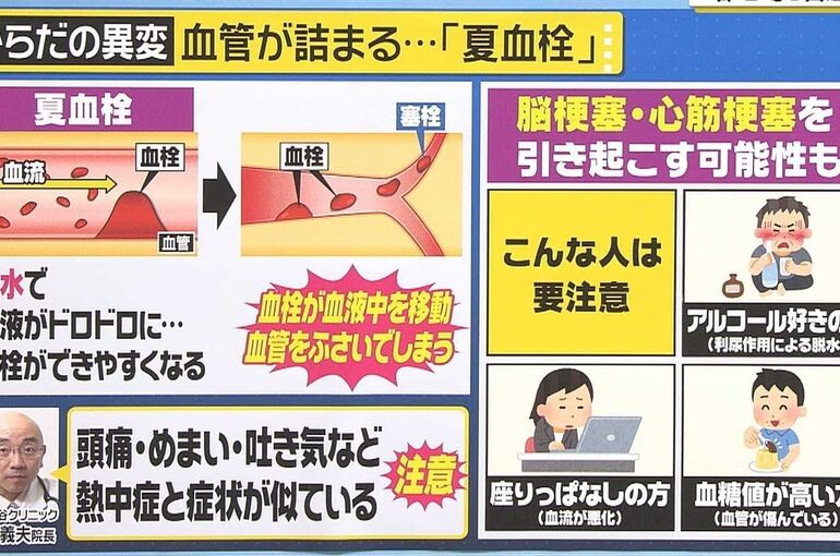 【梅田　整体院　夏バテ】夏血栓（熱中症）に要注意！！j